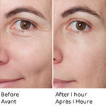 BEFORE AFTER FACE SERUM thumbnail