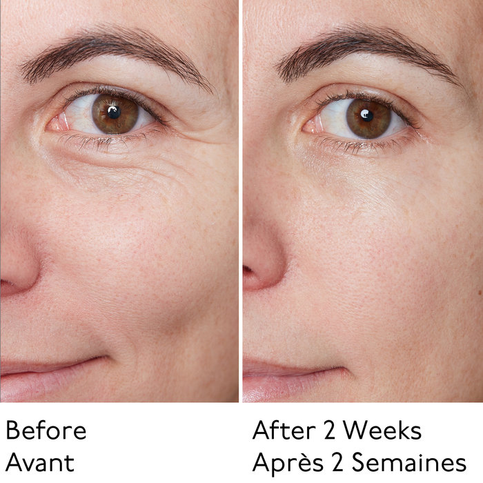ROW FACE SERUM BEFORE AFTER