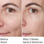 ROW FACE SERUM BEFORE AFTER thumbnail