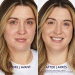 PDP CC Foundation Before After 3 W Erin thumbnail